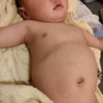 突発性発疹 8ヶ月 不機嫌 ピーク